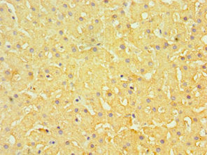 Immunohistochemistry of paraffin-embedded human liver tissue using CSB-PA007465ESR1HU at dilution of 1:100