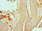 Immunohistochemistry of paraffin-embedded human skin tissue using CSB-PA007466ESR1HU at dilution of 1:100