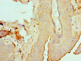 Immunohistochemistry of paraffin-embedded human skin tissue using CSB-PA007466ESR1HU at dilution of 1:100