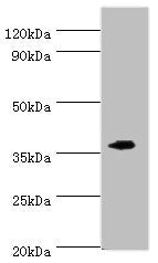 Western blot All lanes: EFNB2 antibody at 6ug/ml + Mouse kidney tissue Secondary Goat polyclonal to rabbit IgG at 1/10000 dilution Predicted band size: 37 kDa Observed band size: 37 kDa