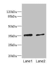 Western blot All lanes: EFNB3 antibody at 1.44ug/ml Lane 1: HepG2 whole cell lysate Lane 2: Hela whole cell lysate Secondary Goat polyclonal to rabbit IgG at 1/10000 dilution Predicted band size: 36 kDa Observed band size: 36 kDa