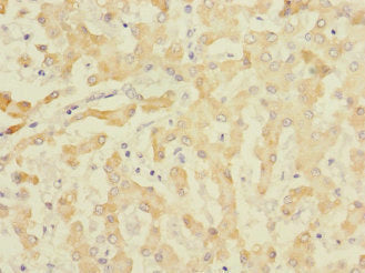 Immunohistochemistry of paraffin-embedded human liver tissue using CSB-PA007467ESR2HU at dilution of 1:100