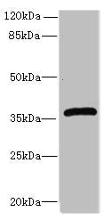 Western blot All lanes: Efnb3 antibody at 12µg/ml + HepG2 whole cell lysate Secondary Goat polyclonal to rabbit IgG at 1/10000 dilution Predicted band size: 36 kDa Observed band size: 36 kDa