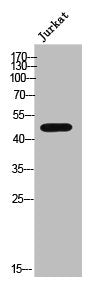Western Blot analysis of Jurkat cells using PP2Cε Polyclonal Antibody