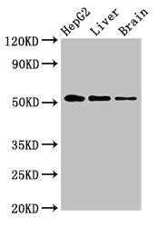Western Blot Positive WB detected in: HepG2 whole cell lysate, Rat liver tissue, Rat brain tissue All lanes: EGR2 antibody at 3.4ug/ml Secondary Goat polyclonal to rabbit IgG at 1/50000 dilution Predicted band size: 51, 45 kDa Observed band size:...