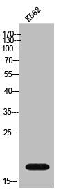 Western Blot analysis of K562 cells using GUSBP1 Polyclonal Antibody