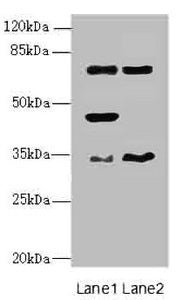 Western blot All lanes: EHF antibody at 4.95ug/ml Lane 1: Mouse brain tissue Lane 2: Mouse lung tissue Secondary Goat polyclonal to rabbit IgG at 1/10000 dilution Predicted band size: 35, 33, 38 kDa Observed band size: 35, 45, 63 kDa