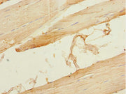 Immunohistochemistry of paraffin-embedded human skeletal muscle tissue using CSB-PA007494ESR2HU at dilution of 1:100