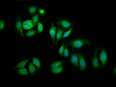 Immunofluorescence staining of A549 cells with CSB-PA007503LA01HU at 1:100, counter-stained with DAPI. The cells were fixed in 4% formaldehyde, permeabilized using 0.2% Triton X-100 and blocked in 10% normal Goat Serum. The cells were then incubat...