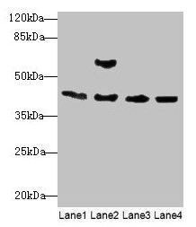 Western blot All lanes: Acta1 antibody at 2µg/ml Lane 1: Mouse brain tissue Lane 2: Mouse lung tissue Lane 3: Rat muscle tissue Lane 4: Zebrafish lysate Secondary Goat polyclonal to rabbit IgG at 1/10000 dilution Predicted band size: 43 kDa Observ...