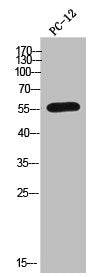 Western Blot analysis of PC-12 cells using CYP2A6 Polyclonal Antibody
