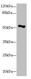 Western blot All lanes: EIF2S3 antibody at 1.13µg/ml + Hela whole cell lysate Secondary Goat polyclonal to rabbit IgG at 1/10000 dilution Predicted band size: 51 kDa Observed band size: 51 kDa