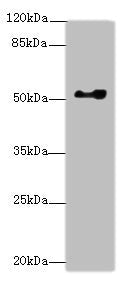 Western blot All lanes: EIF2S3antibody at 0.83ug/ml + Hela whole cell lysate Secondary Goat polyclonal to rabbit IgG at 1/10000 dilution Predicted band size: 51 kDa Observed band size: 51 kDa