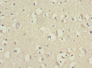 Immunohistochemistry of paraffin-embedded human brain tissue using CSB-PA007535ESR2HU at dilution of 1:100