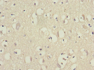 Immunohistochemistry of paraffin-embedded human brain tissue using CSB-PA007535ESR2HU at dilution of 1:100