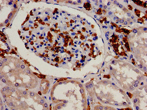 Immunohistochemistry analysis of human kidney tissue using CSB-PA007539LA01HU at dilution of 1:100