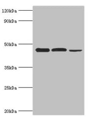 Western blot All lanes: Eukaryotic initiation factor 4A-I antibody at 3ug/ml Lane 1: K562 whole cell lysate Lane 2: Hela whole cell lysate Lane 3: Rat brain tissue Secondary Goat polyclonal to rabbit IgG at 1/10000 dilution Predicted band size: 47...