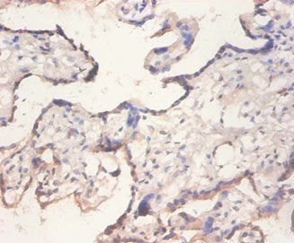 Immunohistochemistry of paraffin-embedded human placenta tissue using CSB-PA007563DA01HU at dilution of 1:100