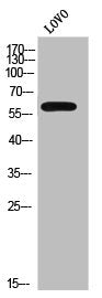 Western Blot analysis of LOVO cells using CYP2C8/9/18/19 Polyclonal Antibody