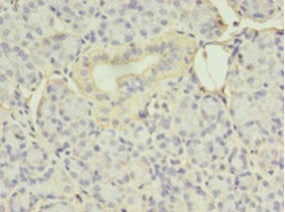Immunohistochemistry of paraffin-embedded human pancreatic tissue using CSB-PA007565HA01HU at dilution of 1:100