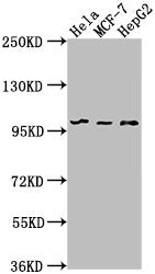 Western Blot Positive WB detected in: Hela whole cell lysate, MCF-7 whole cell lysate, HepG2 whole cell lysate All lanes: EIF4G2 antibody at 1:1000 Secondary Goat polyclonal to rabbit IgG at 1/50000 dilution Predicted band size: 103, 99 kDa Observ...