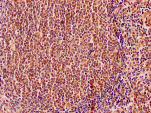 IHC image of CSB-PA007573HA01HU diluted at 1:200 and staining in paraffin-embedded human tonsil tissue performed on a Leica BondTM system. After dewaxing and hydration, antigen retrieval was mediated by high pressure in a citrate buffer (pH 6.0)....