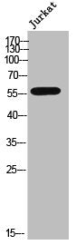 Western Blot analysis of Jurkat cells using CYP3A4/5 Polyclonal Antibody
