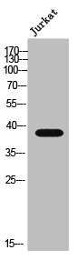 Western Blot analysis of Jurkat cells using NSE2 Polyclonal Antibody