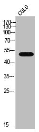 Western Blot analysis of COLO cells using CYP4B1 Polyclonal Antibody