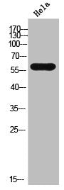 Western Blot analysis of HeLa cells using CYP11A1 Polyclonal Antibody