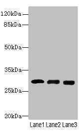 Western blot All lanes: CELA3A antibody at 14µg/ml Lane 1: Mouse heart tissue Lane 2: Mouse skeletal muscle tissue Lane 3: Jurkat whole cell lysate Secondary Goat polyclonal to rabbit IgG at 1/10000 dilution Predicted band size: 30 kDa Observed ba...