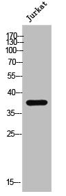 Western Blot analysis of Jurkat cells using DHHC-15 Polyclonal Antibody