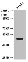 Western Blot Positive WB detected in: Mouse brain tissue All lanes: ELK1 antibody at 3ug/ml Secondary Goat polyclonal to rabbit IgG at 1/50000 dilution Predicted band size: 45, 12 kDa Observed band size: 45 kDa