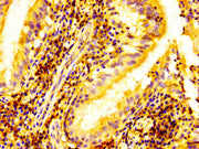 IHC image of CSB-PA007606LA01HU diluted at 1:500 and staining in paraffin-embedded human lung tissue performed on a Leica BondTM system. After dewaxing and hydration, antigen retrieval was mediated by high pressure in a citrate buffer (pH 6.0). Se...