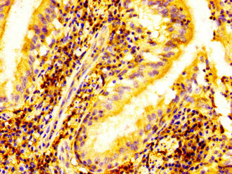 IHC image of CSB-PA007606LA01HU diluted at 1:500 and staining in paraffin-embedded human lung tissue performed on a Leica BondTM system. After dewaxing and hydration, antigen retrieval was mediated by high pressure in a citrate buffer (pH 6.0). Se...