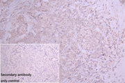 Immunohistochemistry of paraffin-embedded human skeletal muscle tissue using CSB-PA007632ESR1HU at dilution of 1:100