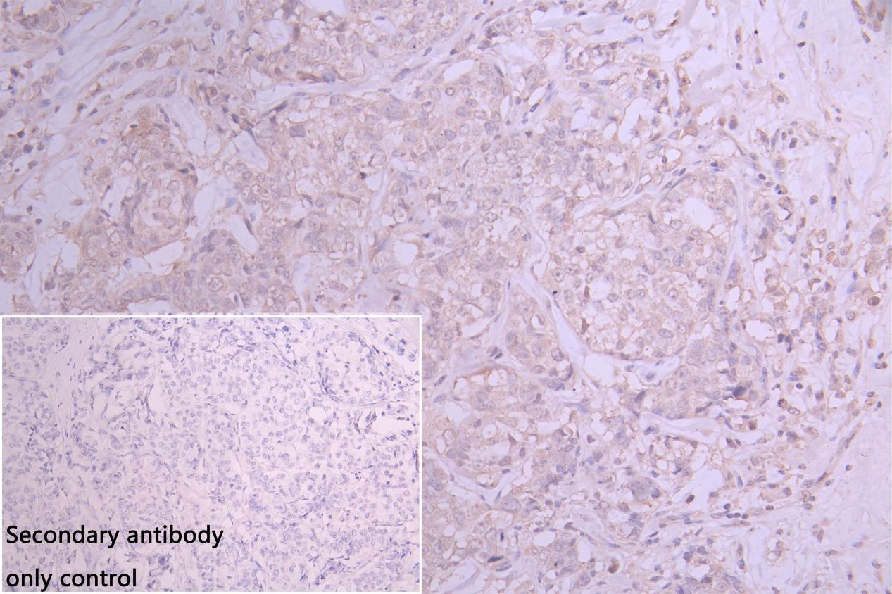 Immunohistochemistry of paraffin-embedded human skeletal muscle tissue using CSB-PA007632ESR1HU at dilution of 1:100