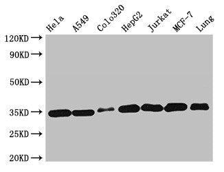 Western Blot Positive WB detected in: Hela whole cell lysate, A549 whole cell lysate, Colo320 whole cell lysate, HepG2 whole cell lysate, Jurkat whole cell lysate, MCF-7 whole cell lysate, Mouse lung tissue All lanes: EMD antibody at 2µg/ml Second...