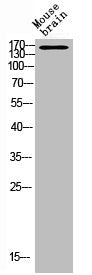 Western Blot analysis of MOUSE-BRAIN cells using DAPK1 Polyclonal Antibody