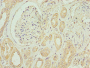 Immunohistochemistry of paraffin-embedded human kidney tissue using CSB-PA007648LA01HU at dilution of 1:100