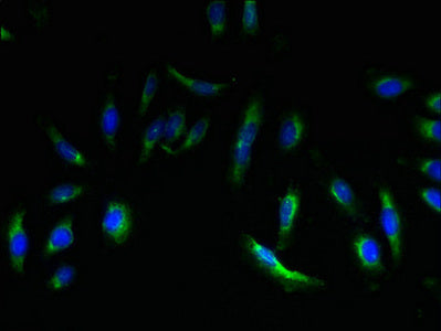 Immunofluorescent analysis of Hela cells using CSB-PA007650LA01HU at dilution of 1:100 and Alexa Fluor 488-congugated AffiniPure Goat Anti-Rabbit IgG(H+L)