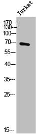 Western Blot analysis of Jurkat cells using DBH Polyclonal Antibody