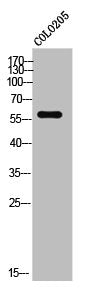 Western Blot analysis of COLO205 cells using Elongin A3 Polyclonal Antibody