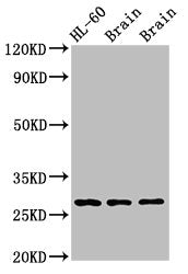 Western Blot Positive WB detected in: Rat brain tissue, Mouse brain tissue All lanes: EMX2 antibody at 2.7ug/ml Secondary Goat polyclonal to rabbit IgG at 1/50000 dilution Predicted band size: 29, 19 kDa Observed band size: 29 kDa