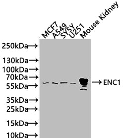 Western Blot Positive WB detected in: MCF7 whole cell lysate(20µg), A549 whole cell lysate(20µg), SY5Y whole cell lysate(20µg), U251 whole cell lysate(20µg),Mouse Kidney tissue lysate(20µg) All lanes: ENC1 antibody at 1:1000 Secondary Goat polyclo...