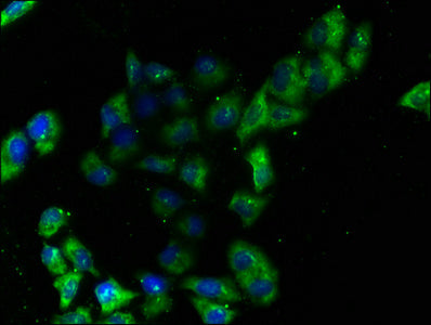 Immunofluorescence staining of Hela cells with CSB-PA007667LA01HU at 1:100, counter-stained with DAPI. The cells were fixed in 4% formaldehyde, permeabilized using 0.2% Triton X-100 and blocked in 10% normal Goat Serum. The cells were then incubat...