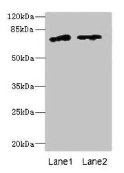 Western blot All lanes: ENOX1 antibody at 5µg/ml Lane 1: Jurkat whole cell lysate Lane 2: Raji whole cell lysate Secondary Goat polyclonal to rabbit IgG at 1/10000 dilution Predicted band size: 74, 28 kDa Observed band size: 74 kDa