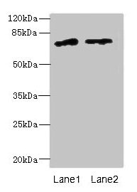 Western blot All lanes: ENOX1 antibody at 5µg/ml Lane 1: Jurkat whole cell lysate Lane 2: Raji whole cell lysate Secondary Goat polyclonal to rabbit IgG at 1/10000 dilution Predicted band size: 74, 28 kDa Observed band size: 74 kDa