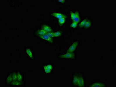 Immunofluorescent analysis of HepG2 cells using CSB-PA007679LA01HU at dilution of 1:100 and Alexa Fluor 488-congugated AffiniPure Goat Anti-Rabbit IgG(H+L)