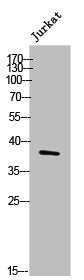 Western Blot analysis of Jurkat cells using Doublecortin Polyclonal Antibody